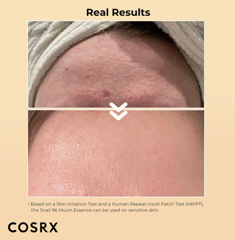 COSRX أدفانسد سنيل 96 ميوسين باور ايسنس