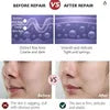 • Retinol cream (Anti-Aging)
