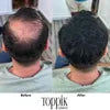 عرض عبوتين Toppik Hair Fibers لفراغات الشعر ( اللون اسود )