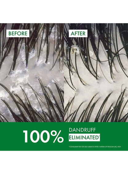 Dercos Anti Dandruff Shampoo For Dry Hair 200ml