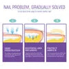 عرض 2 قطعة من NAIL FANGUS SPRAY
