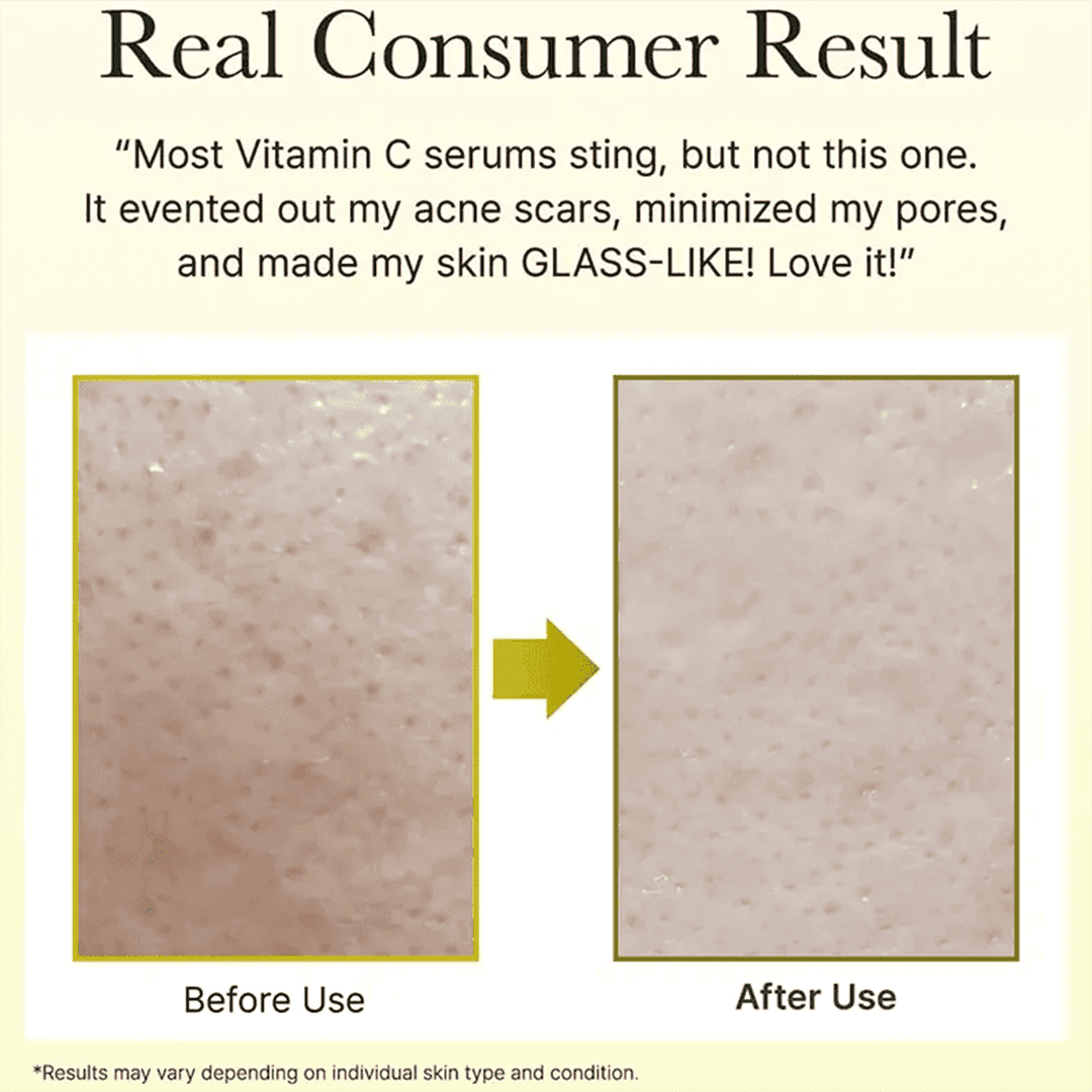 Arencia Face And Eye Cream Moisturizer Vitamin C Booster Shot