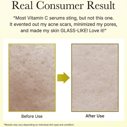 Arencia Face And Eye Cream Moisturizer Vitamin C Booster Shot