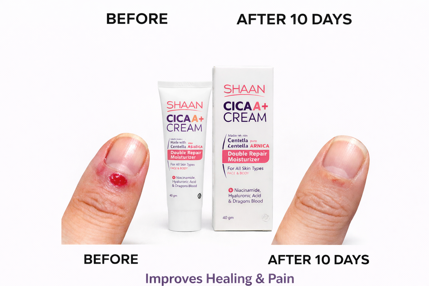 Shaan CICA ARNICA+ cream 40gm