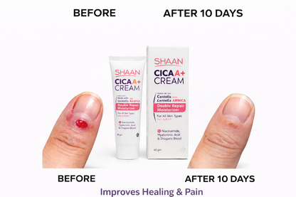 Shaan CICA ARNICA+ cream 40gm