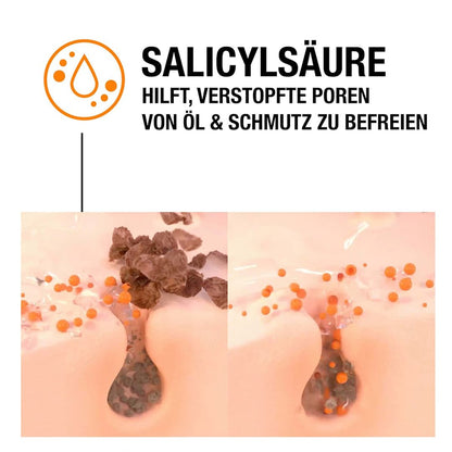 Neutrogena Anti-Pickel SOS Soforthilfe-Gel