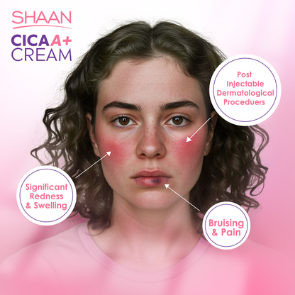 Shaan CICA ARNICA+ cream 40gm