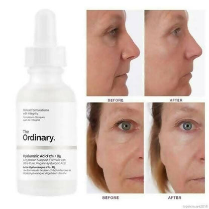 The Ordinary Hyaluronic Acid 2% + B5 - 30ml
