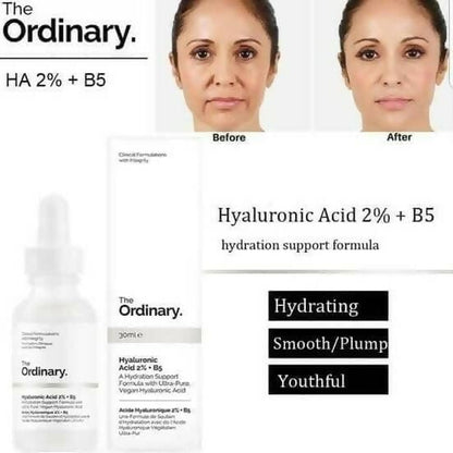The Ordinary Hyaluronic Acid 2% + B5 - 30ml