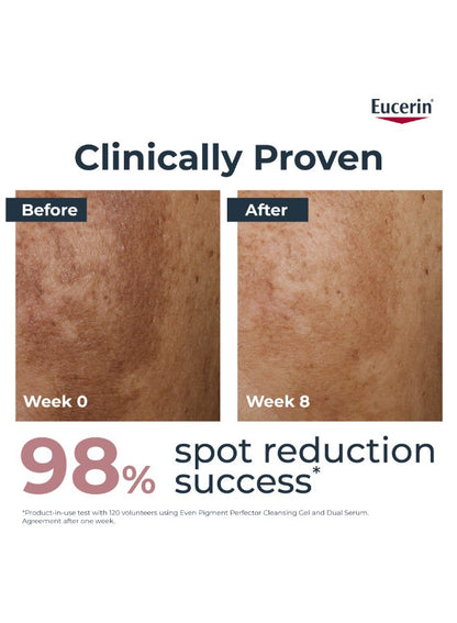 Even Pigment Perfector Dual Face Serum Cream, Reduces Pigment Spots Suitable For All Skin Types 30ml 30ml