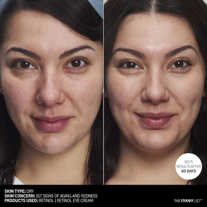 The INKEY List Retinol Anti-Aging Serum