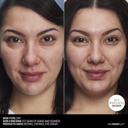 The INKEY List Retinol Anti-Aging Serum