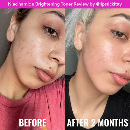 Good Molecules - Niacinamide Brightening Toner